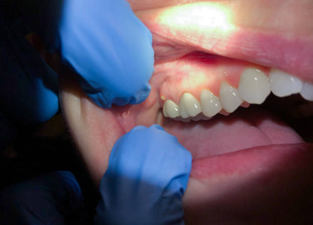 Best After-Hours Emergency Dentist in Robertsville, NJ