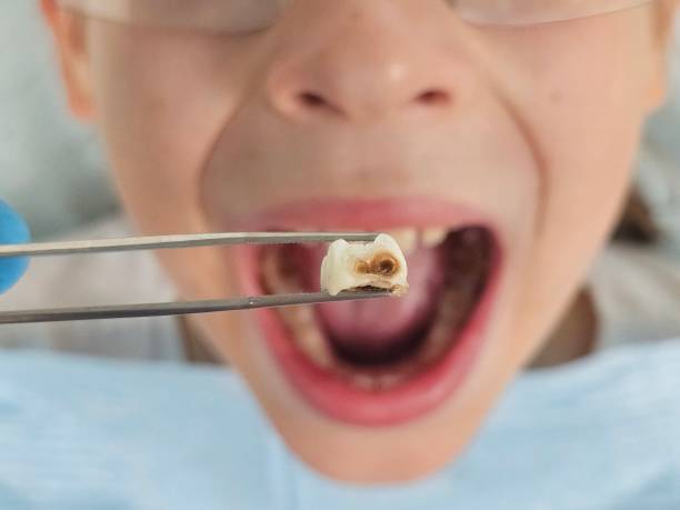 Best Emergency Treatment for Toothache in Robertsville, NJ