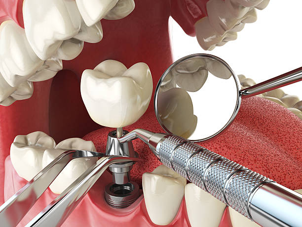 Best Weekend Emergency Dentist in Robertsville, NJ